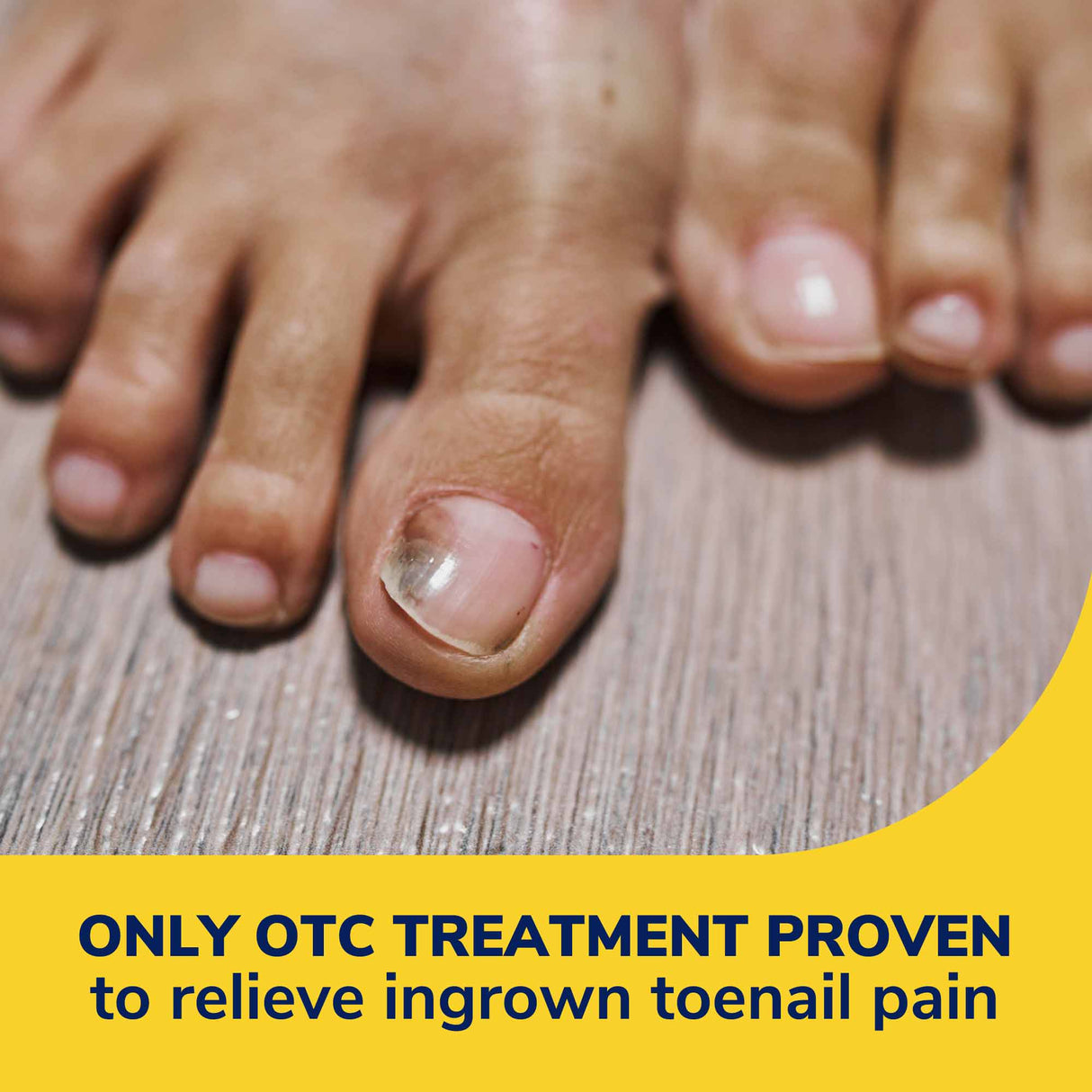 Ingrown Toenail Treatment - Custom Foot Clinic & Orthotic Centre