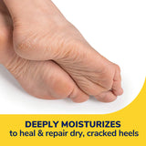 Severe Cracked Heel Repair Restoring Balm